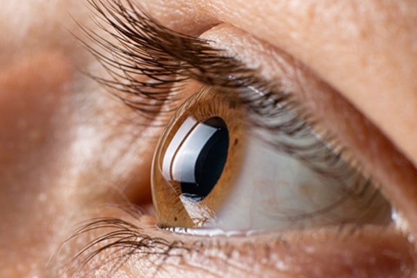 cornee yeux chirurgiens ophtalmologues specialiste cataracte chirurgie des yeux au laser institut laser ophtalmologique voltaire paris