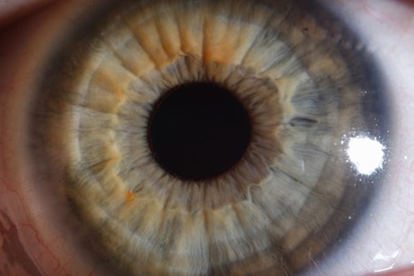 oeil cornee chirurgiens ophtalmologues chirurgie optique refractive yeux cataracte institut laser ophtalmologique voltaire paris